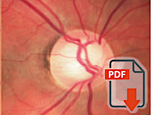 Role of ocular blood flow in normal tension glaucoma