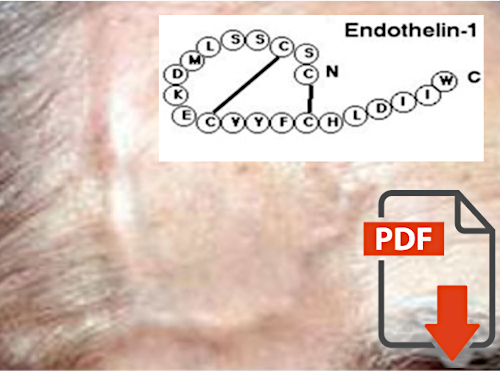 Increased Endothelin-1 Plasma Levels in Giant Cell Arteritis: A Report onFour Patients